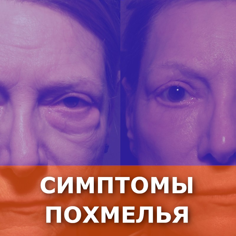 сравнение до употребления алкоголя с состоянием после употребления